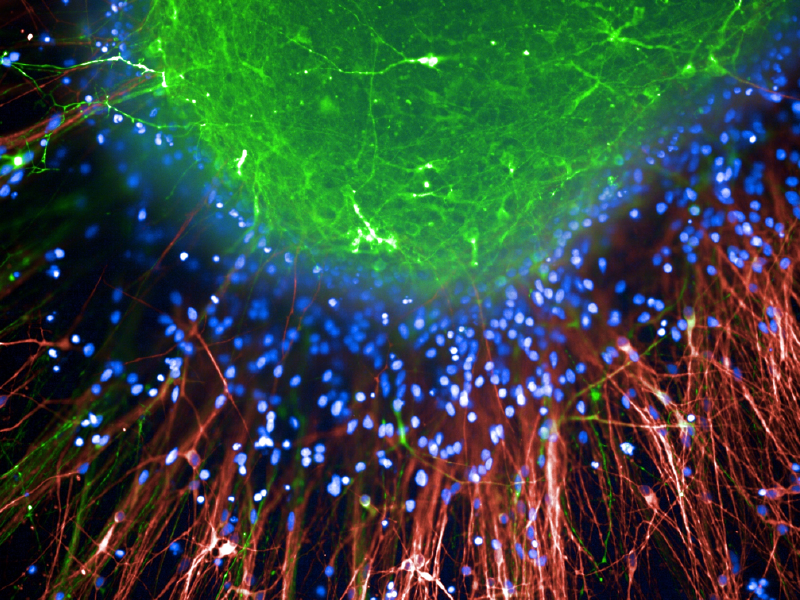 Three-dimensional neuronal culture derived from pluripotent stem cells. Green: tyrosine hydroxylase, a marker for dopamine neurons. Red: MAP2 (microtubule associated protein 2), a marker for mature neurons. Blue: nuclear marker 4',6-diamidino-2-phenylindole (DAPI).
